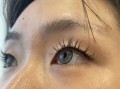 带美瞳眼睛红怎么办，带美瞳眼睛红怎么办快速消除