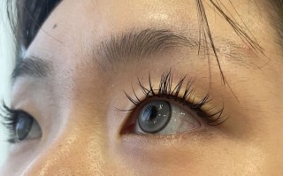 带美瞳眼睛红怎么办,带美瞳眼睛红怎么办快速消除 带美瞳眼睛红怎么办,带美瞳眼睛红怎么办快速消除